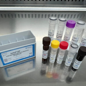 Lactate dehydrogenase-elevating virus detection kits