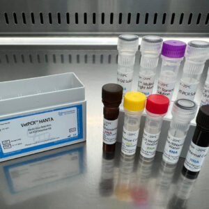 Hanta Virus detection kits