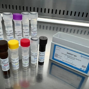 Avian infectious bronchitis virus detection kits