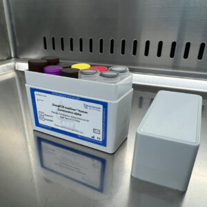 Human Coronavirus alpha detection kits