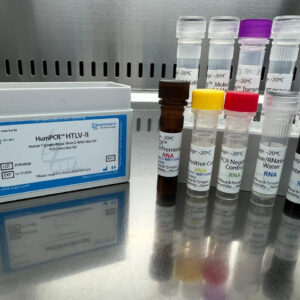 Human T-lymphotropic Virus 2 detection kits