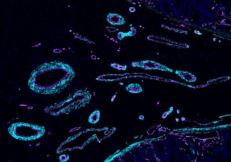 Why the Human Cell Atlas Is Transforming Biology