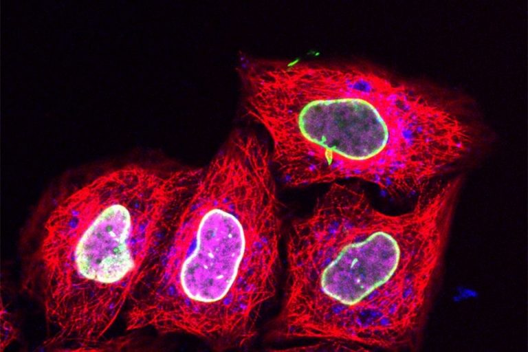 Join the Webinar: A New Era in Analytical Protein Expression