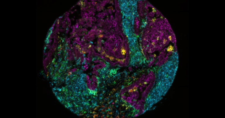 Lunaphore at SITC 2025: Amplifying Discovery Through Spatial Biology