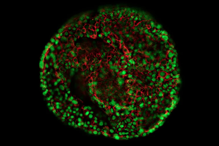 Multiscale Imaging Workflows for Organoid Imaging