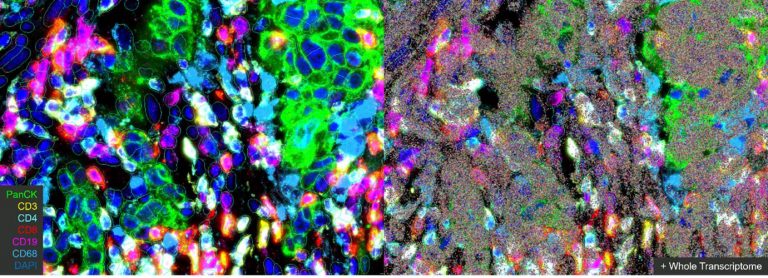 Seeing the Unseen: A Translational Spatial Experience at AACR 2026