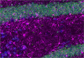 Confidently Visualize Oncology Biomarkers in Tissues and Make Meaningful Discoveries with RNAscope™
