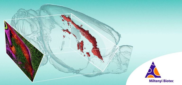 Webinar: Linking 2D and 3D Spatial Biology for Multiscale Mapping of Complex Tissues