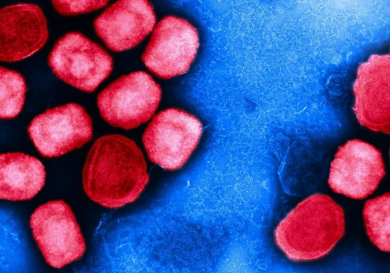 Up to One in Three Positive Mpox PCR Results in DRC May Be False Positives, Lancet Study Finds